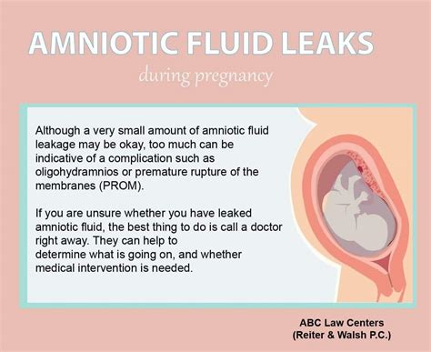 leaking amniotic fluid look like|Signs Of Leaking Amniotic Fluid Vs. Discharge: The。